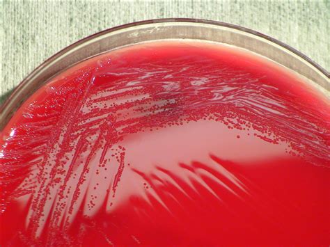 acinetobacter pronunciation|acinetobacter lwoffii.